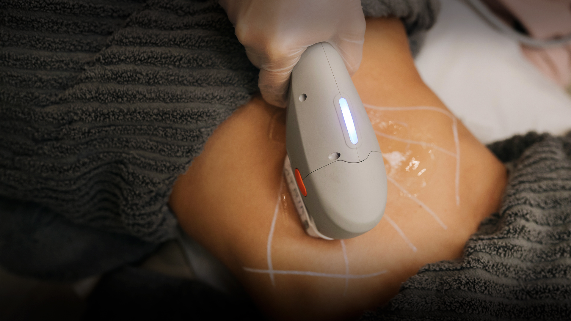 Cuide-se com a gente e veja a transforma&ccedil;&atilde;o acontecer!