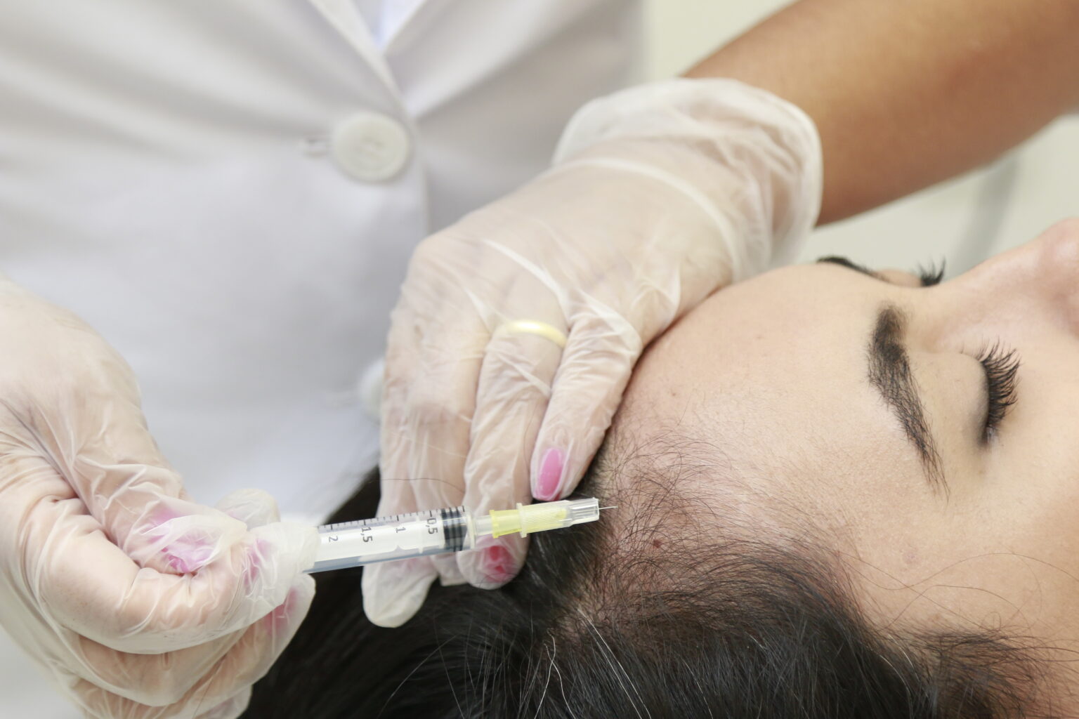 Queda de cabelo? Veja como a Terapia Capilar pode te ajudar