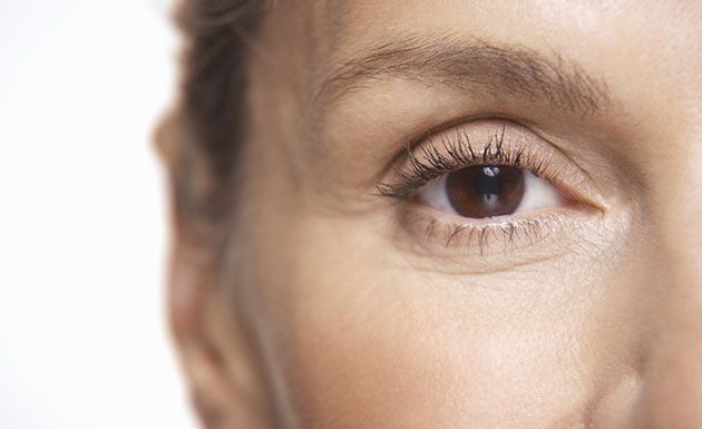 3 tratamentos que funcionam para suavizar bolsas e olheiras