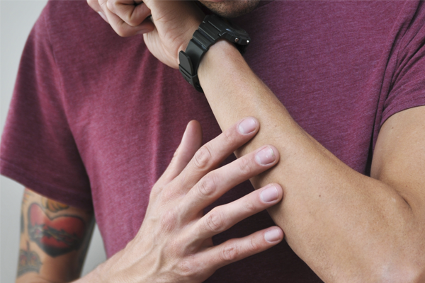 Manchas brancas na pele: o que pode ser e como evitar