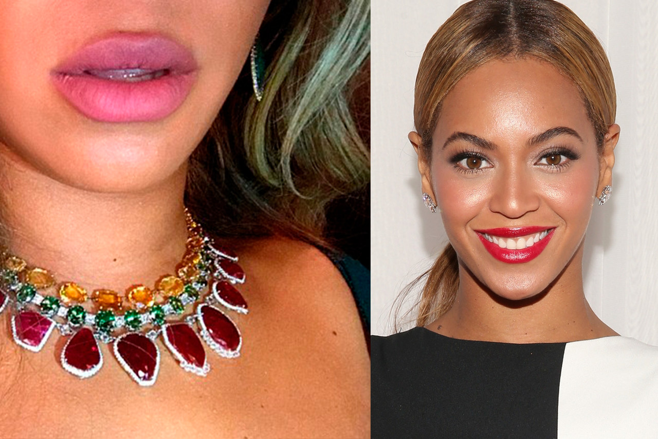 Beyoncé fez preenchimento labial?