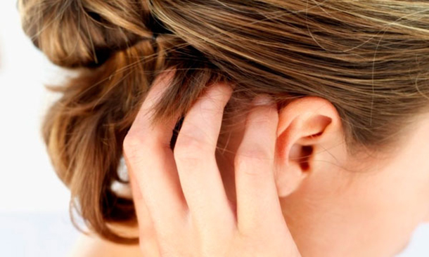 Maneiras de prevenir a caspa.