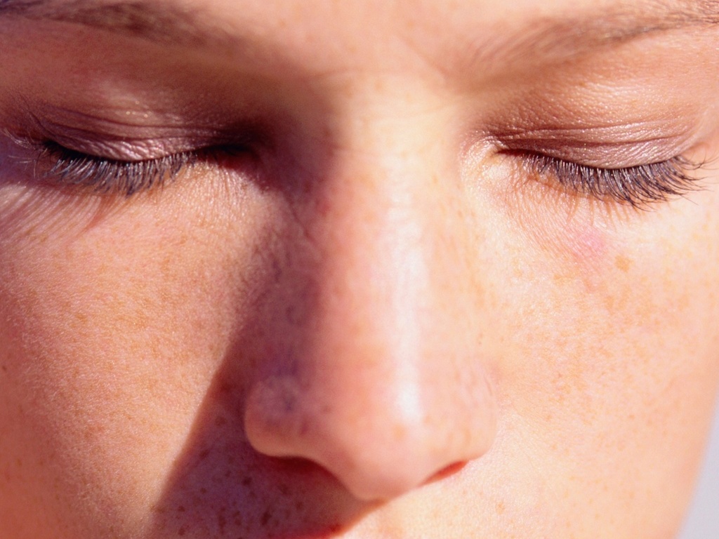 Sauna, calor do fogão e muito mormaço podem piorar o melasma