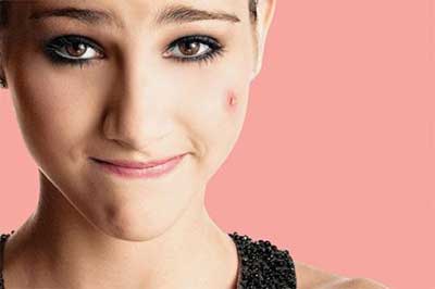 20 medicações que podem causar espinhas ou piorar a acne